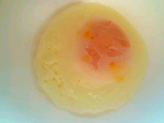 レンジで目玉蒸し レシピ 作り方 By シロコマメ 楽天レシピ レンジで目玉蒸し レシピ 作り方 By シロコマメ 楽天レシピ