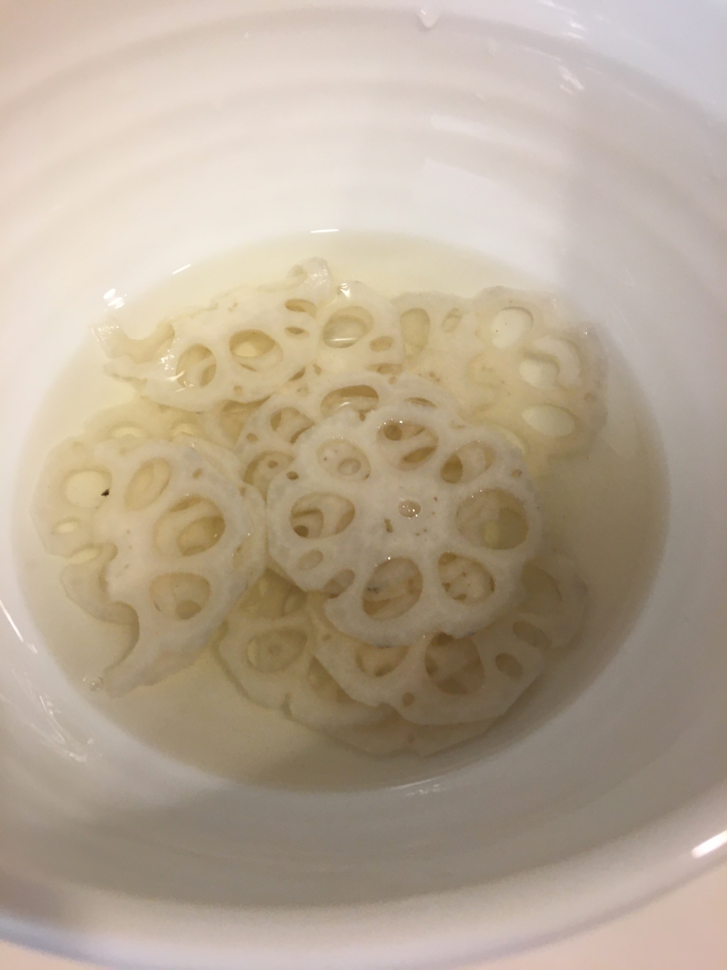 ちらし寿司やご飯のお供に!蓮根の酢漬け!お弁当にも