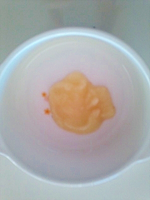 離乳食初期 2週目 とろとろジャガイモ レシピ 作り方 By まめつぶすけ 楽天レシピ 離乳食初期 2週目 とろとろジャガイモ レシピ 作り方 By まめつぶすけ 楽天レシピ